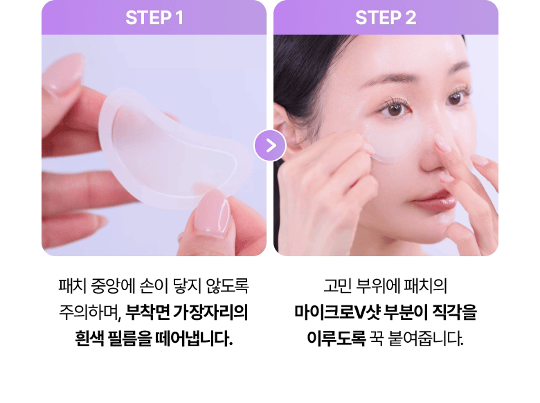 BIOHEAL BOH 膠原蛋白PDRN微針微晶眼袋/眉間貼片 6800發 🔥
