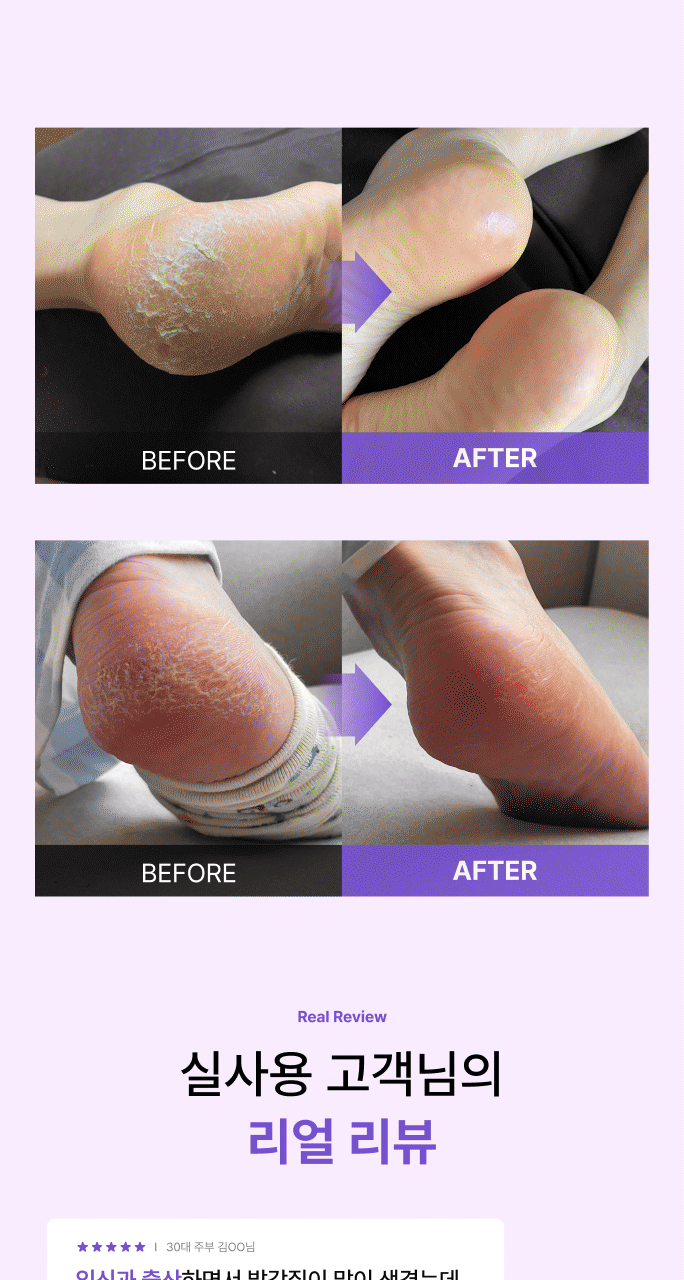 送工具✨Baren足部去角質死皮軟化液⭐️