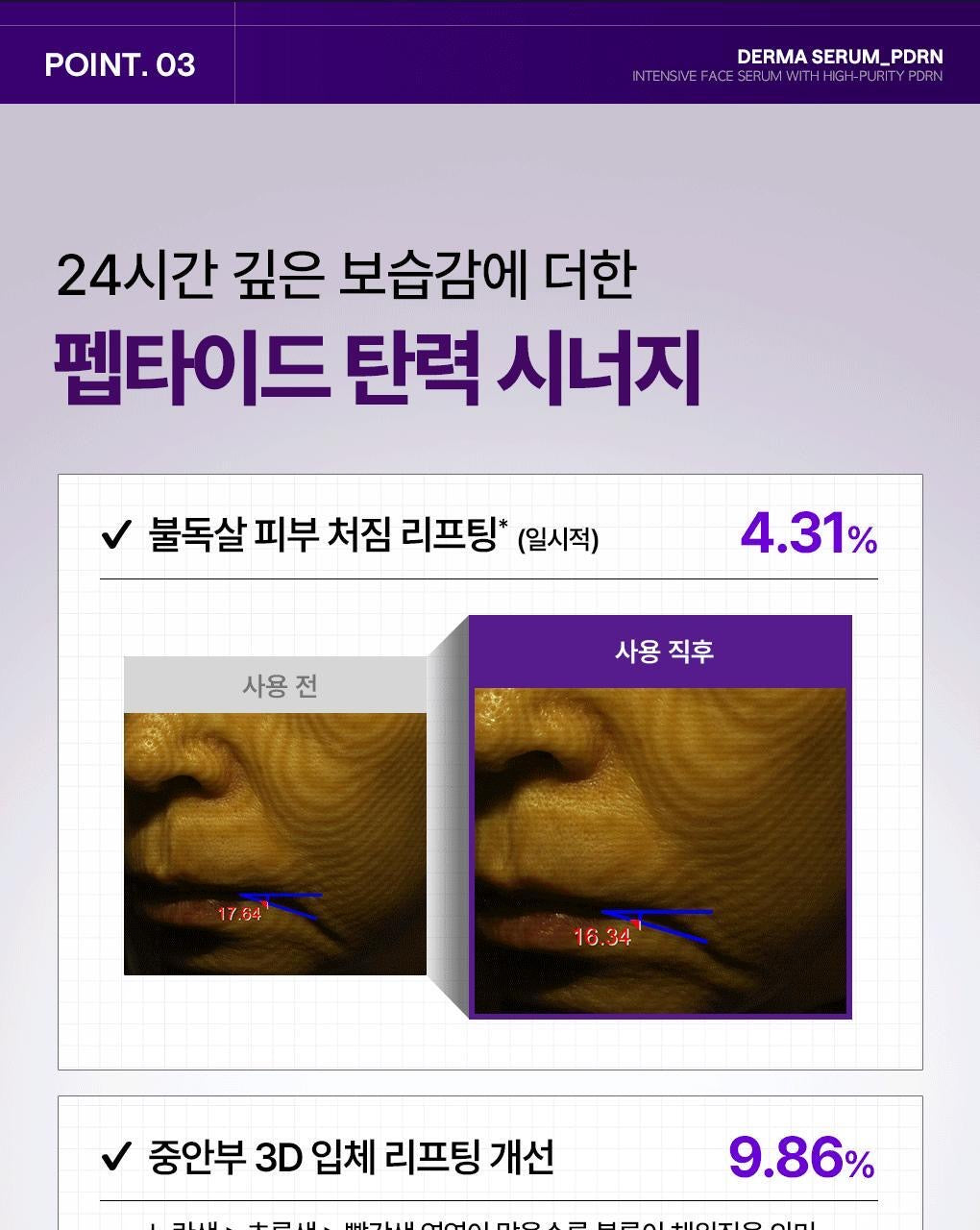🔥 毛孔隱形小紫瓶!新品✨MEDIHEAL PDRN 毛孔彈力精華💜 MEDIHEAL DERMA SERUM PDRN PORE