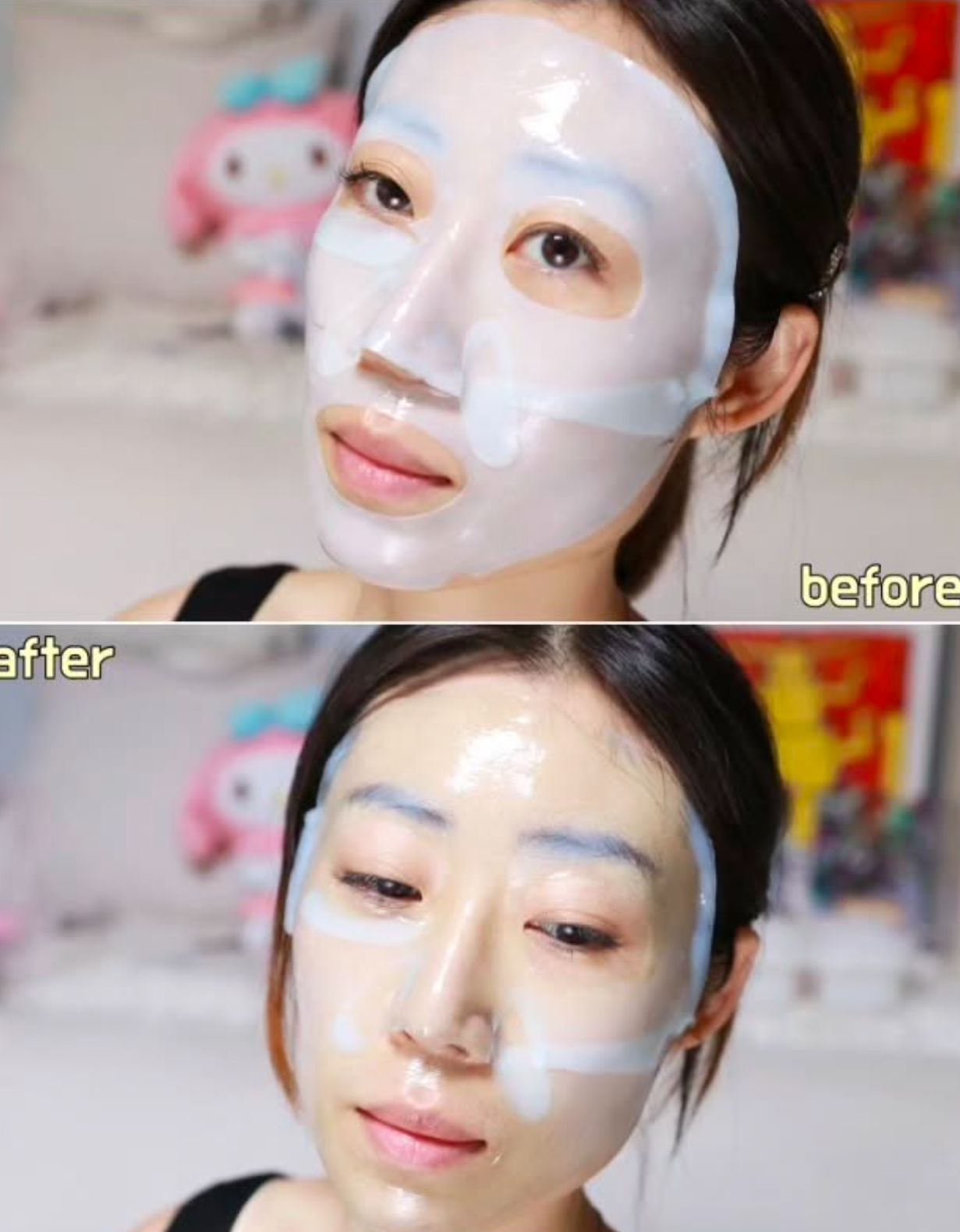 醫美等級面膜🩺DERMAFIX 膠原蛋白凝膠面膜 🥚| DERMAFIX Perfect Real Performance Mask