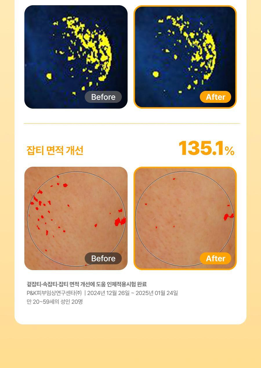 李英芝 PICK🧡Dr.G維他命美白抗黑色素防曬精華SPF50+ PA++++☀️