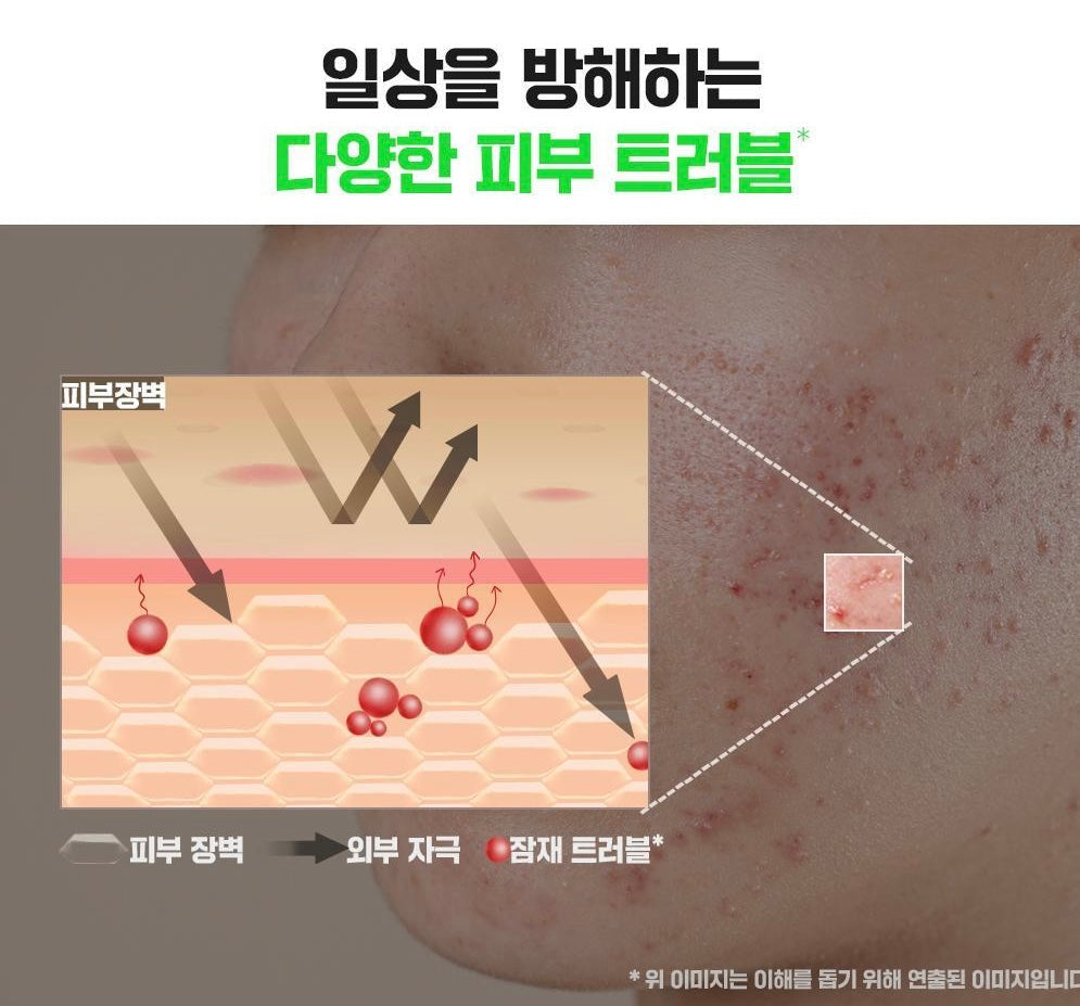 大容量+送旅行裝✨東亞藥廠出品🥼Fation完美淨痘舒緩面霜套裝| Fation Noscar9 Trouble Cream Set 🌱