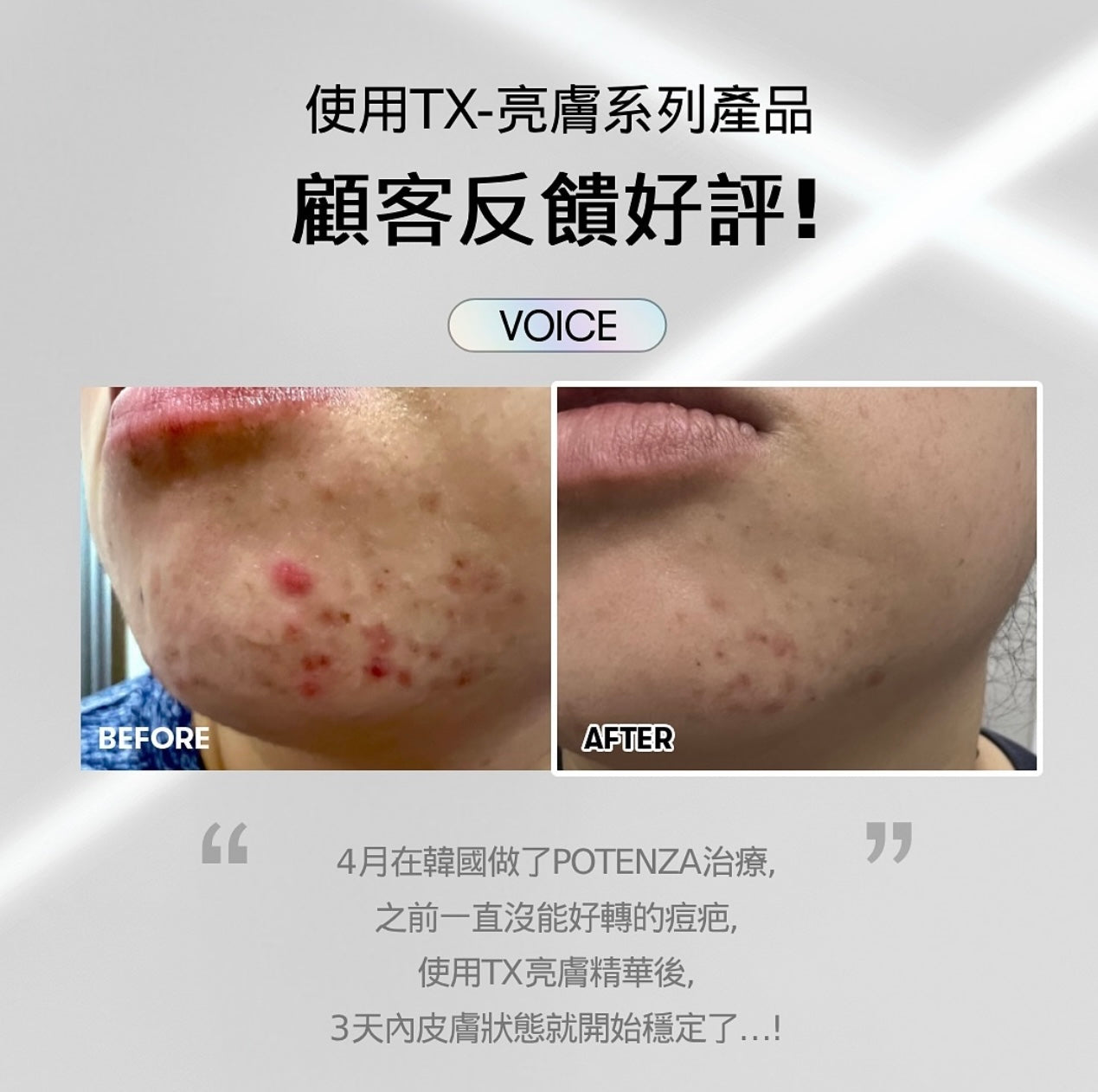 VT TX 傳明酸高效提亮保濕面膜☁️| VT TX-toning Daily Moist & Soothing Mask