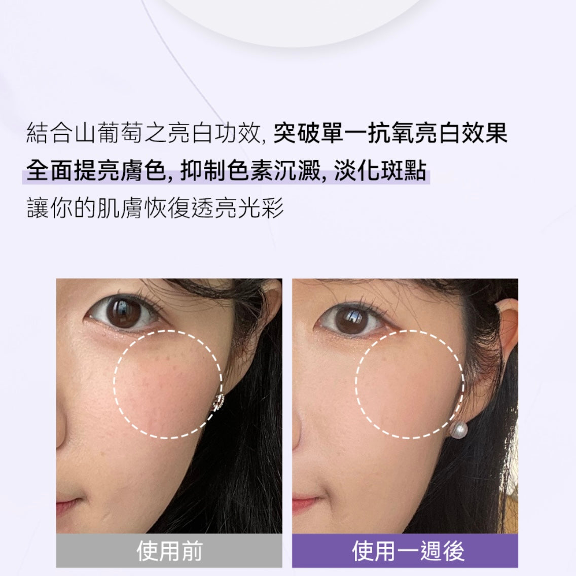 Sungboon Editor 山葡萄維他命C亮白棉片🪻 Sungboon Editor Meoru Podo VitaC Turn Over Dark Spot Pad💜