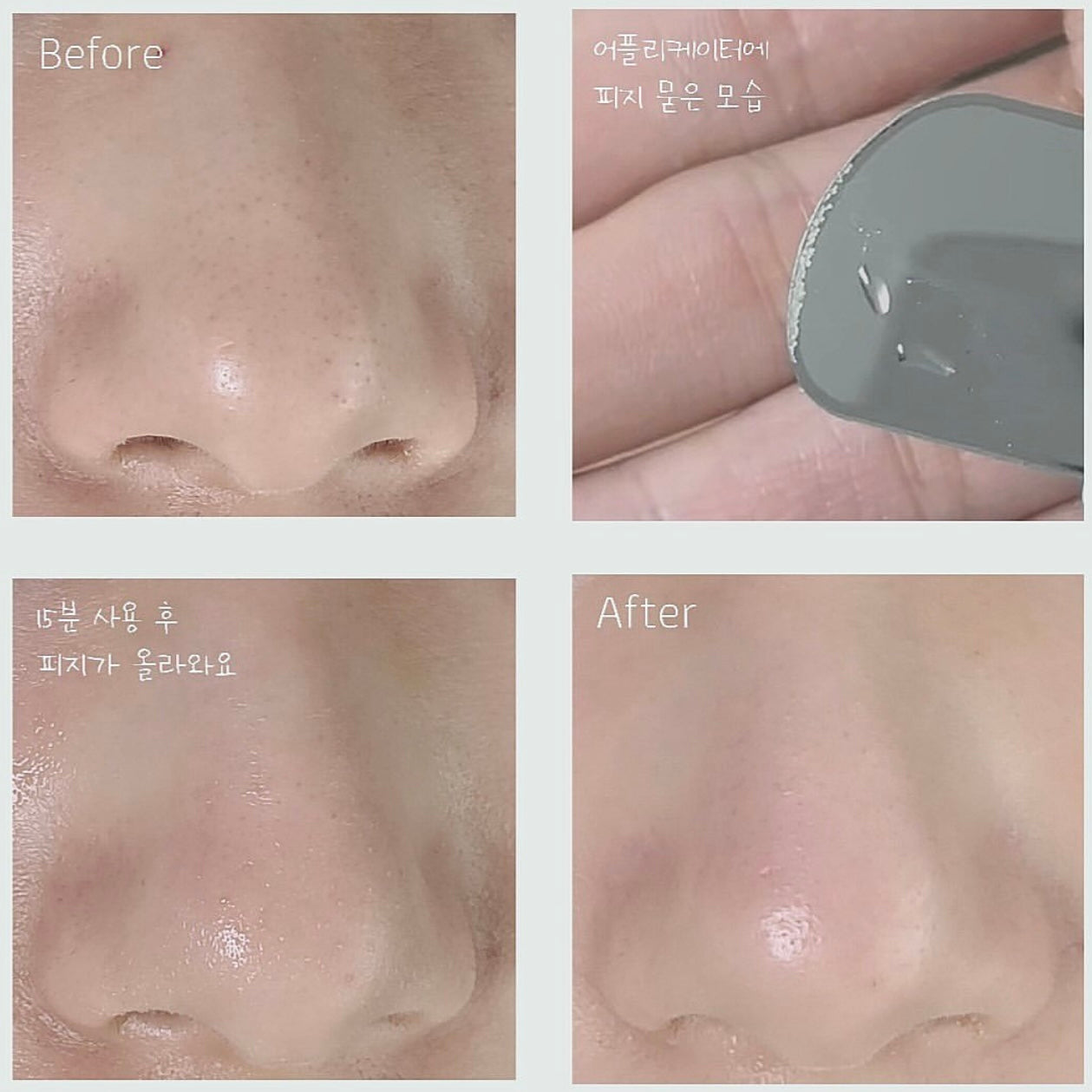 Hello Kitty x Ilso 限量特別版💖黑頭粉刺必試款🧹| Ilso溶解皮脂收毛孔導出液套裝 Ilso Super Melting Sebum Softener🦋