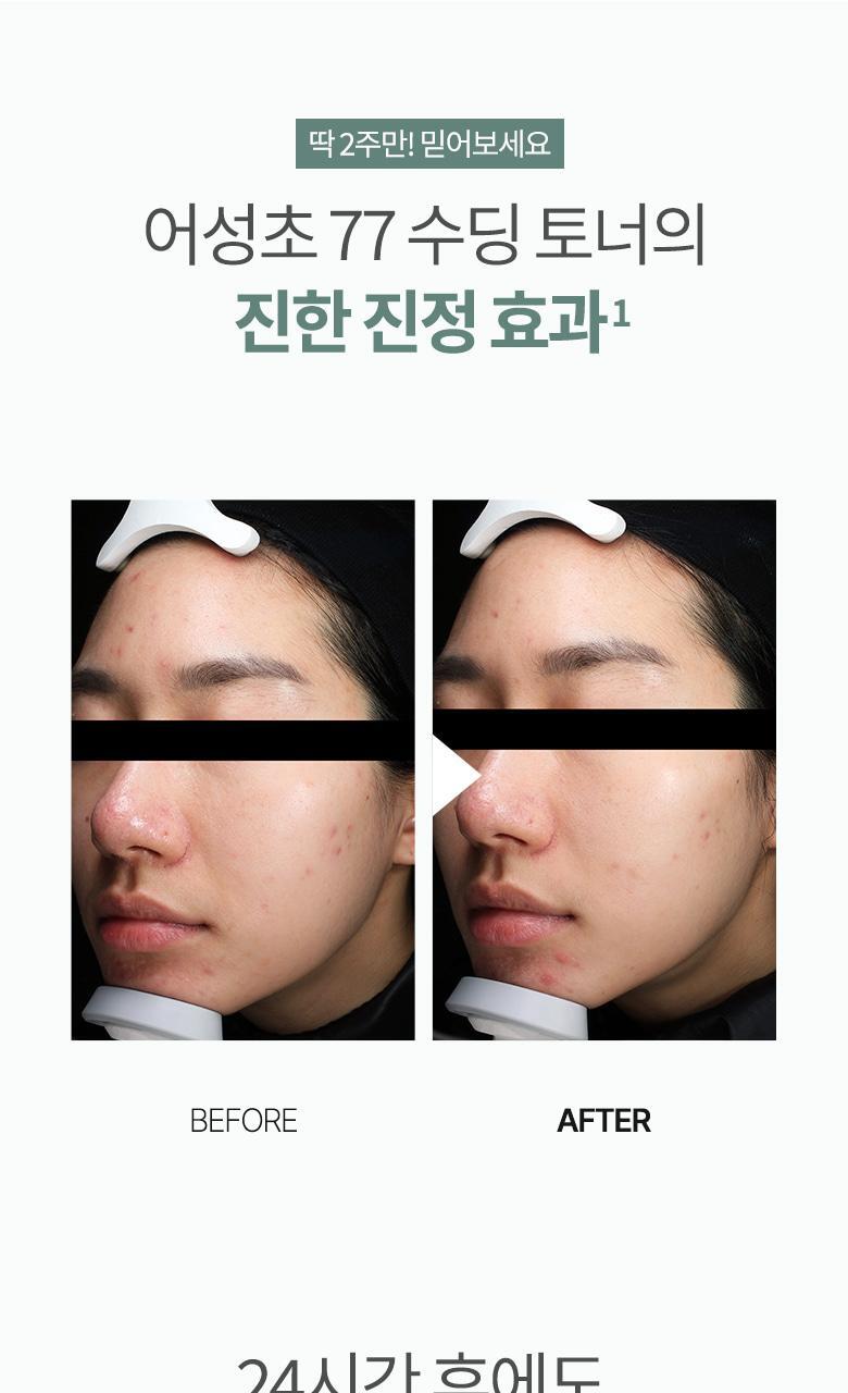 送100ml 乳液✨Anua韓國小眾護膚品牌 77% 魚腥草去暗粒爽膚水🤩主要成份為魚腥草