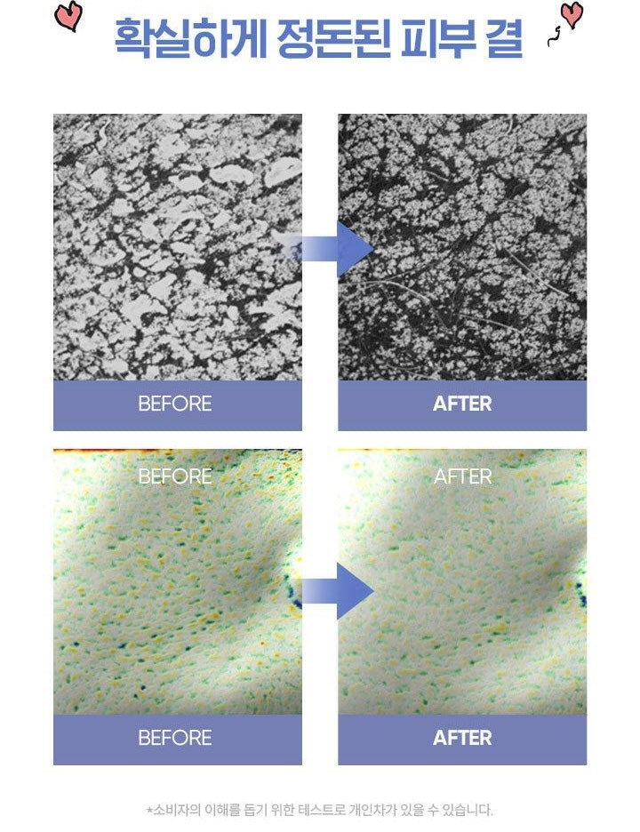 送Sally Brown鏡子匙扣✨Banila Co皇牌零感舒緩鎮靜深層潔淨卸妝膏💖 Banila Co Clean It Zero All In One Cleanser