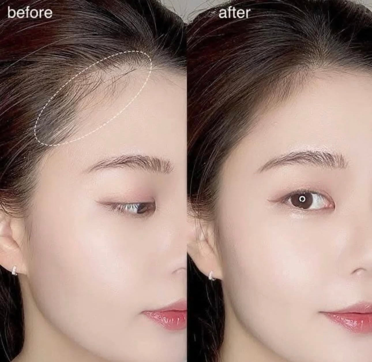 微禿女孩救星⭐️|ETUDE PANG PANG 髮際線修飾陰影粉 👱🏻‍♀️