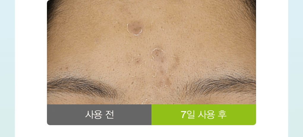 送土豆熊行李牌✨Abib 魚腥草積雪草舒緩膠囊精華液 🌿 Abib Heartleaf TECA Capsule Serum 敏感肌的安心選擇🧏🏻‍♀️