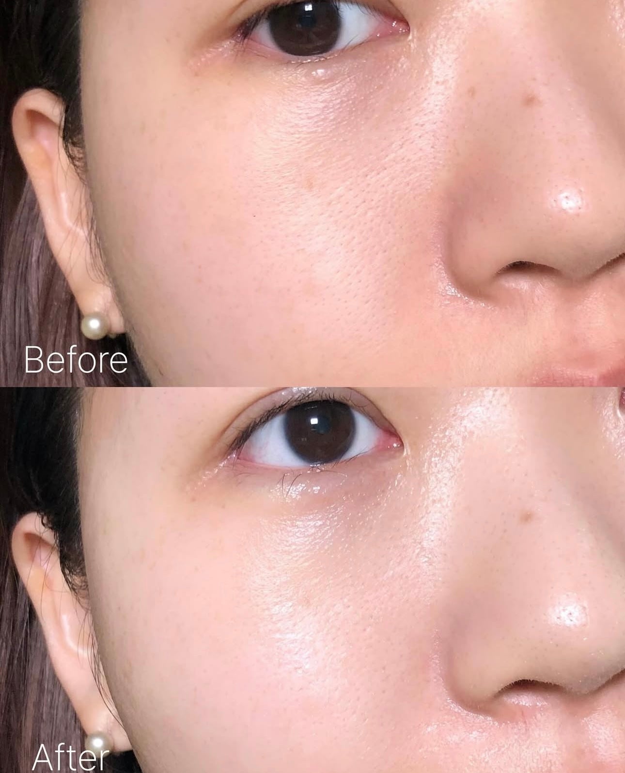 30秒舒緩爆痘肌✨| 韓國熱銷百萬片SKIN1004 馬達加斯加積雪草舒緩抗痘棉片☁️| SKIN1004 MADAGASCAR CENTELLA QUICK CALMING PAD