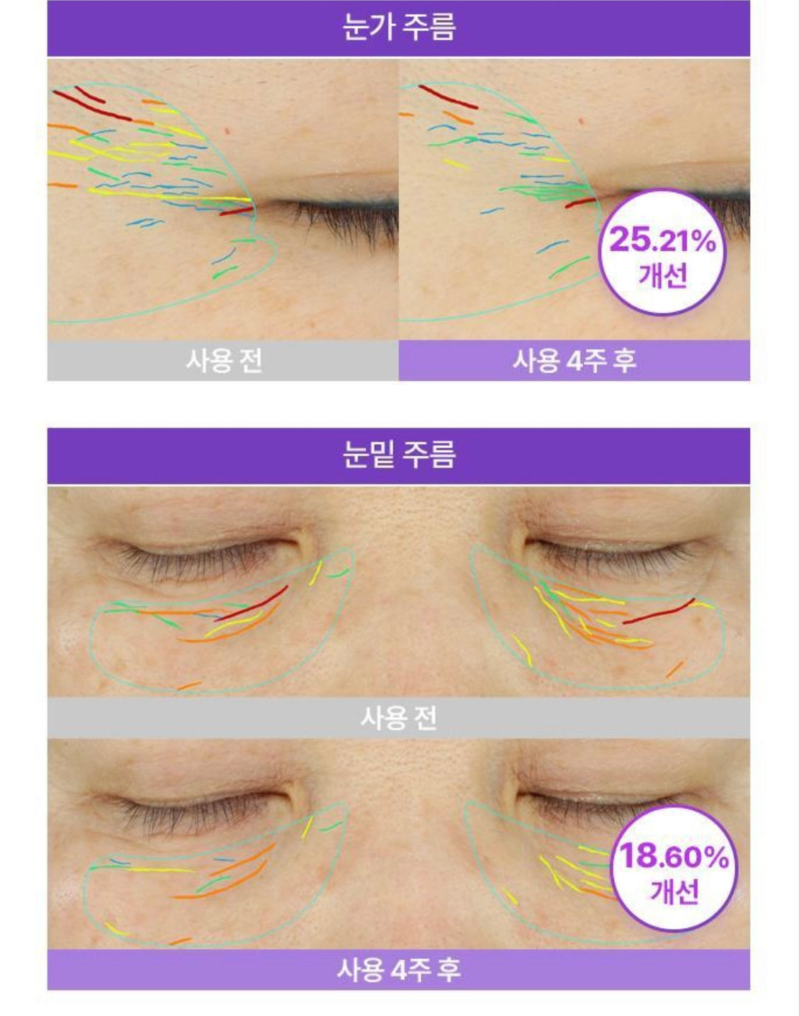 修復舒緩雙重加持💫BOH PROBIODERM 3D立體緊緻益生菌眼霜💜| BOH PROBIODERM 3D Lifting Eye & Wrinkle Cream