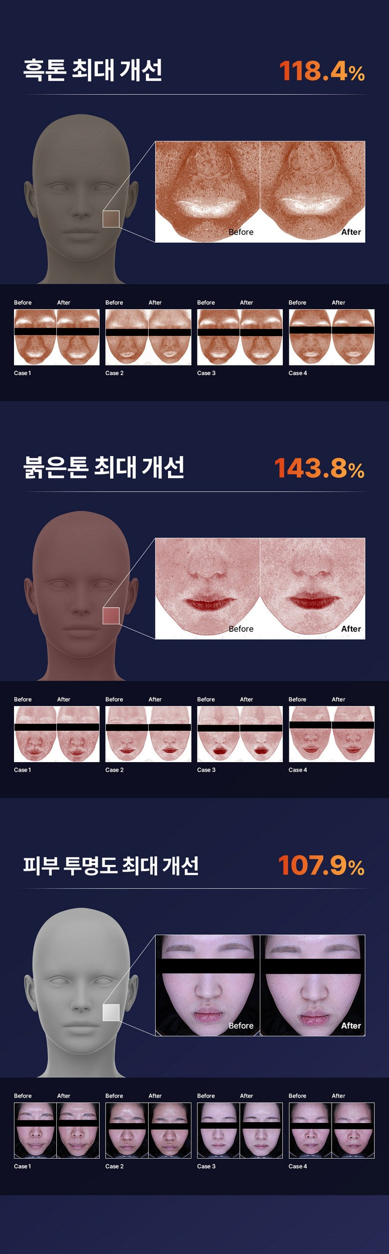 「黃金發光彈」✨Mommy Care Orthotamin 15%高純維C淡斑美白面膜💡
