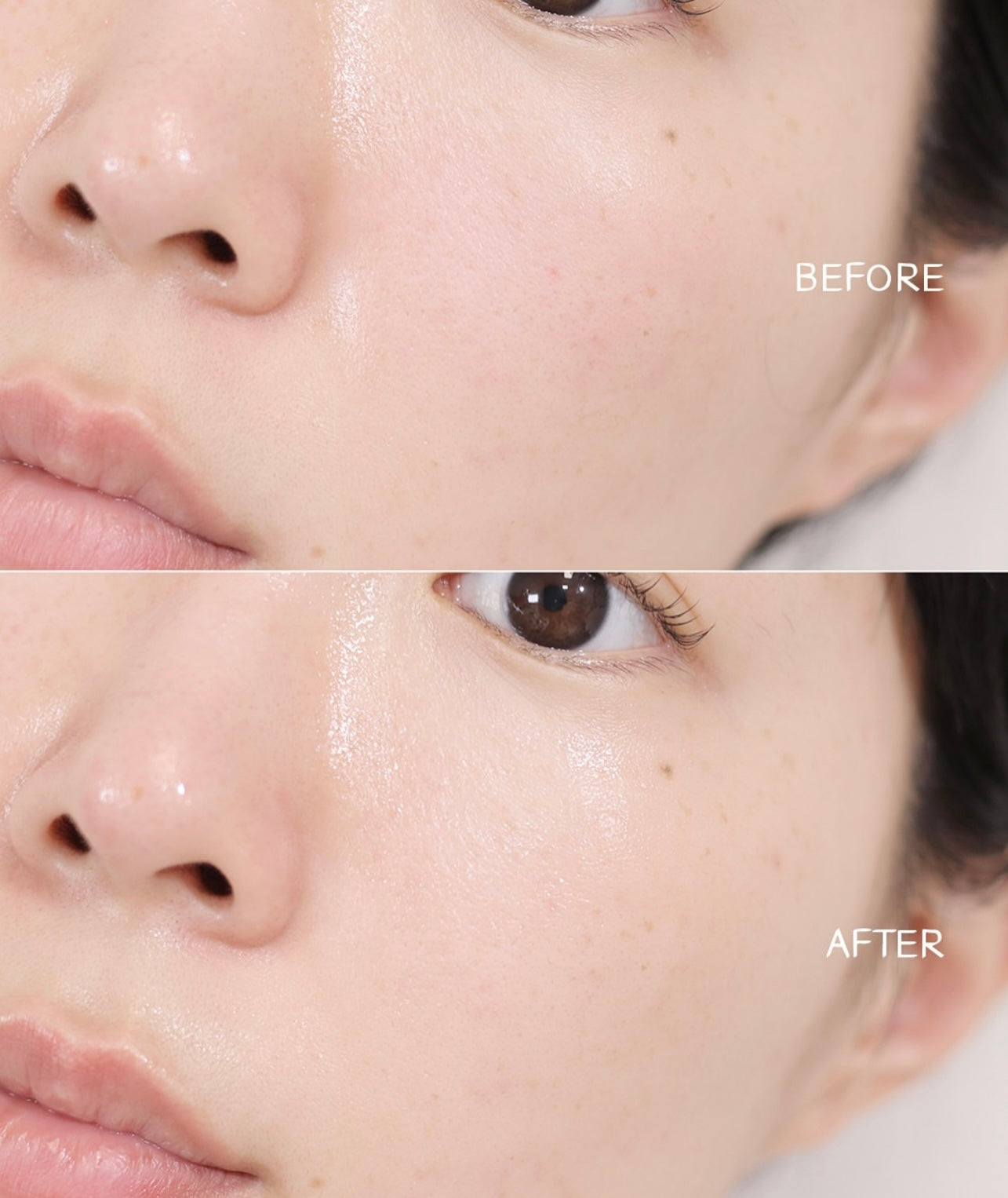 送面霜/爽膚水✨新升級⭐️ Torriden 積雪草控油去痘舒緩精華🌿 | Torriden Balanceful Control Serum| 專為油痘肌敏感肌打造⭐️