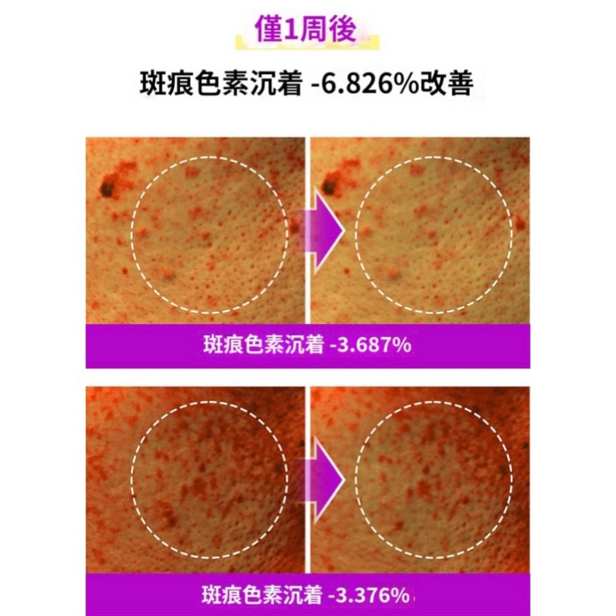 Sungboon Editor 山葡萄維他命C亮白棉片🪻 Sungboon Editor Meoru Podo VitaC Turn Over Dark Spot Pad💜