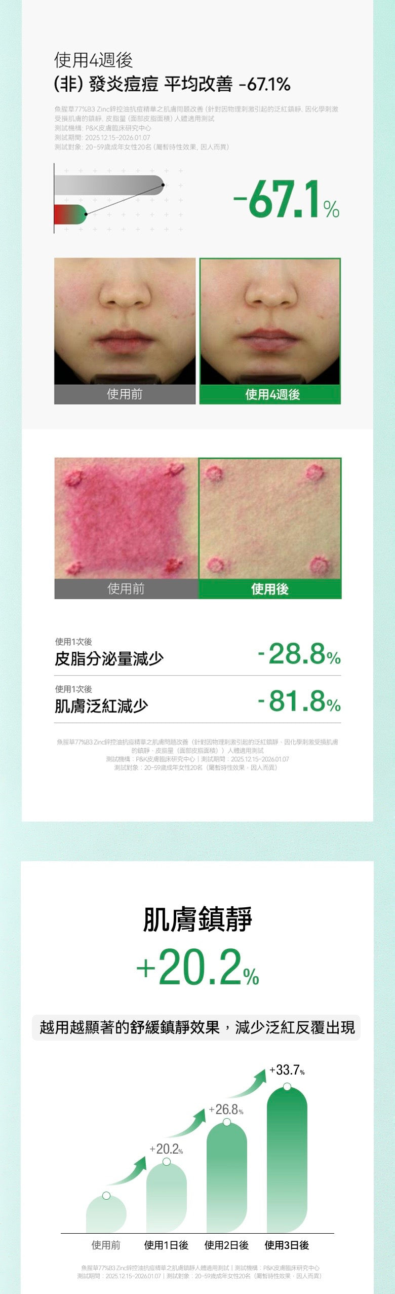 限時優惠$118🌟 【油痘肌救星】Anua 魚腥草77% B3 Zinc 鋅控油抗痘精華🍃✨