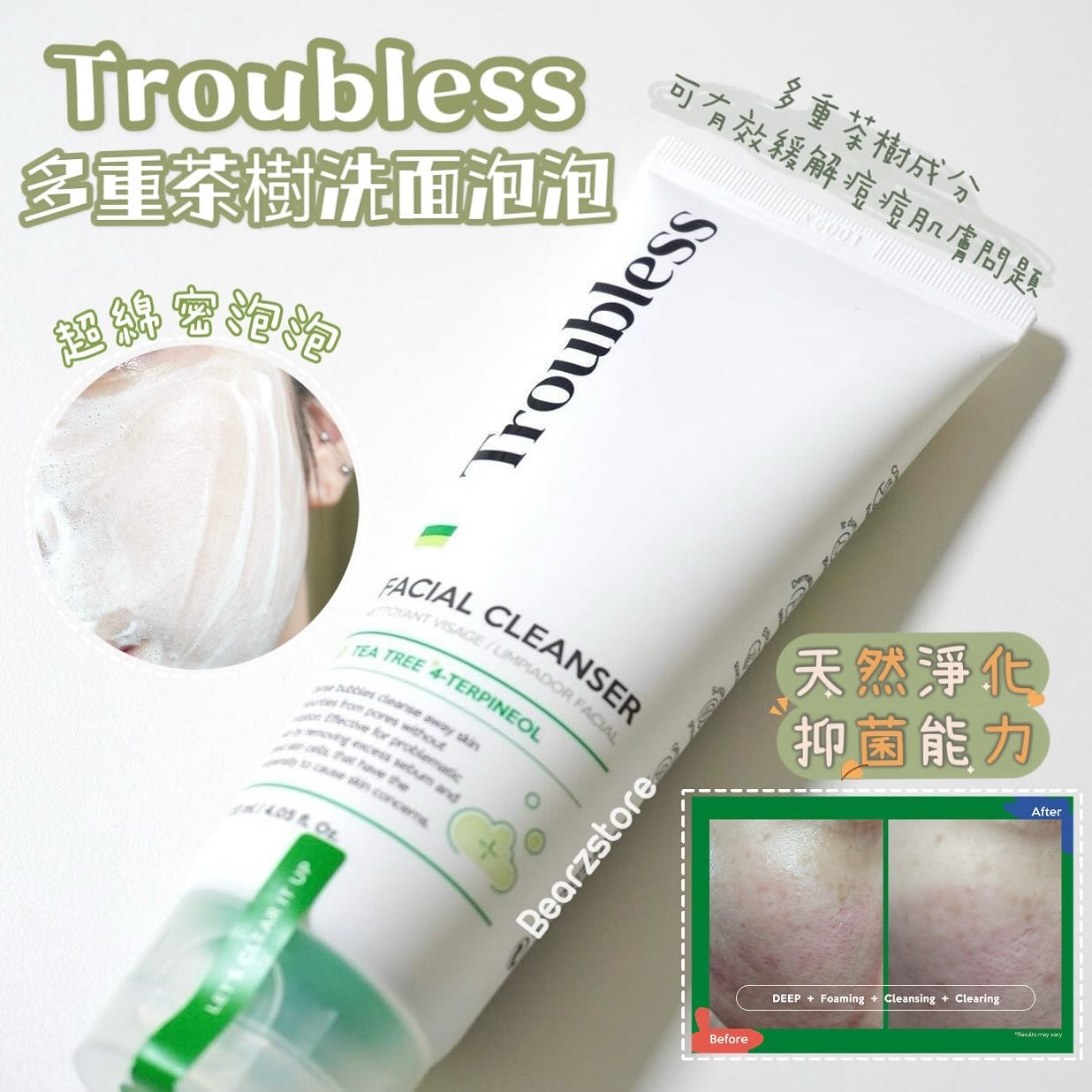 高達98%使用滿意度⭐️| TROUBLESS 多重茶樹洗面泡泡Troubless Facial Cleanser 🫧|推薦痘痘泛紅肌