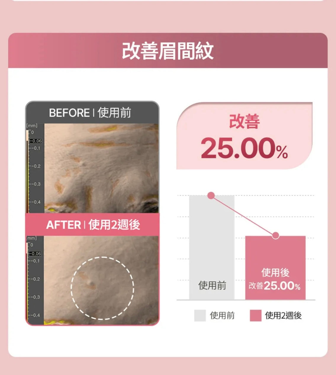 肌膚越用越年輕！Face Fit Wrinkle Patch 小熨斗皺紋貼 ⭐️