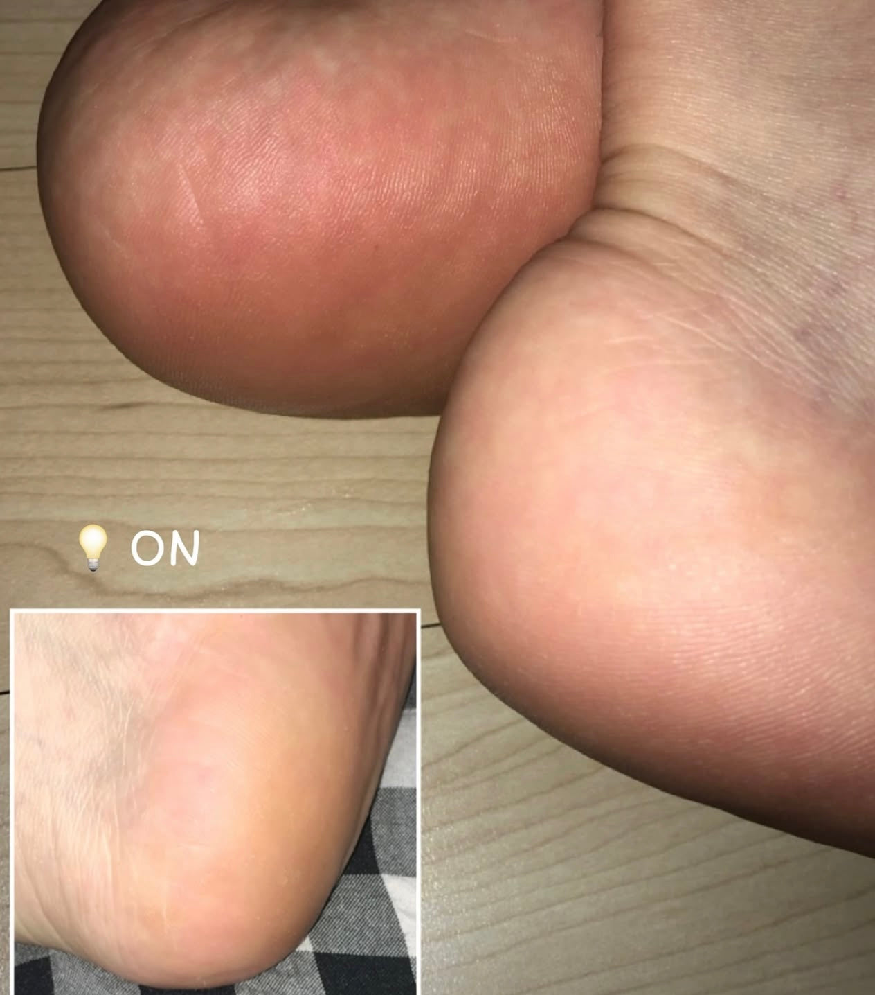 送死皮刮刀✨Plu 強效角蛋白強化修護足霜+完美足部去角質套裝 🦶🏻| PLU Intensive Repair Foot Cream