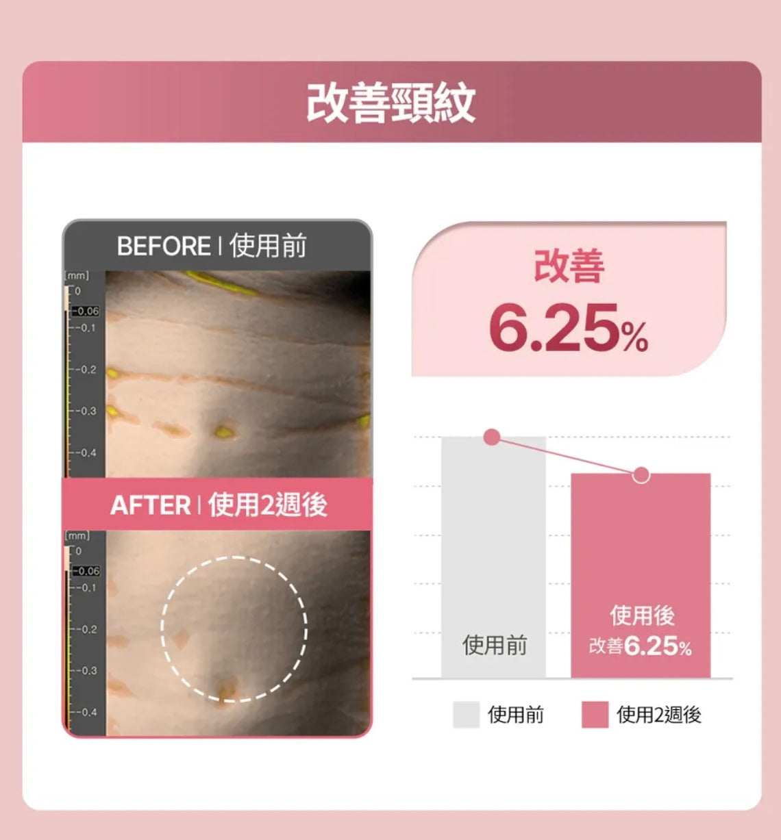 肌膚越用越年輕！Face Fit Wrinkle Patch 小熨斗皺紋貼 ⭐️