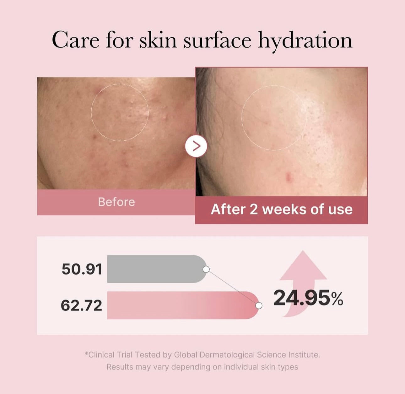 打造彈潤玻璃肌✨ | Medicube PDRN 粉紅穀胱甘肽精華噴霧💝| Medicube PDRN Pink Glutathione Serum Mist