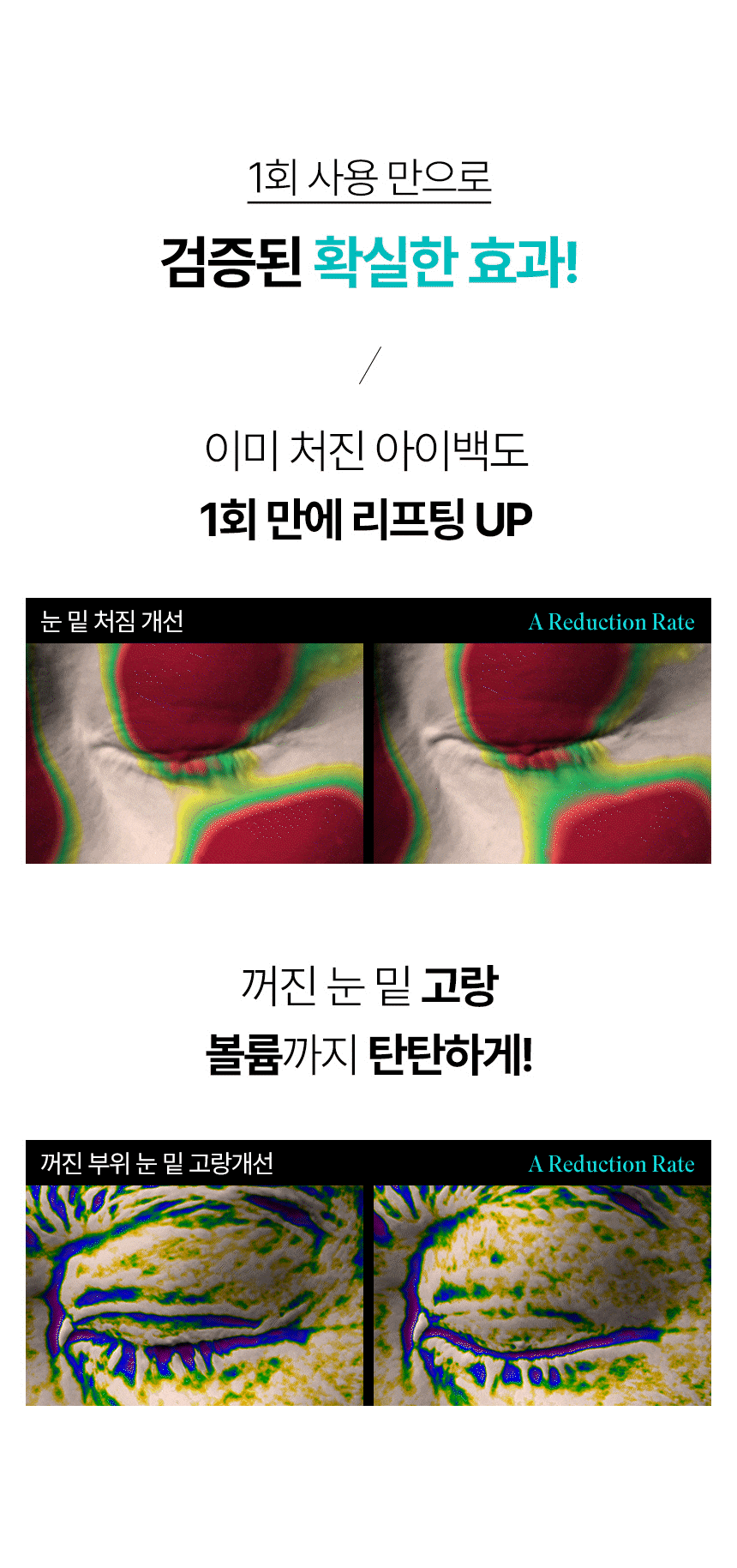 CHARDE 1100 shot 微針玻尿酸眼貼💉💧| 高純度玻尿酸直接灌入肌底🪽