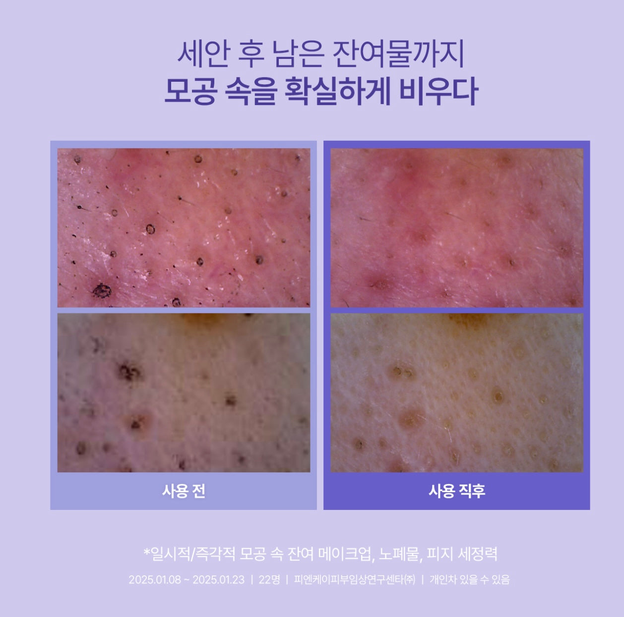 送精華✨Rejuran 高純度PDRN毛孔緊緻控油爽膚棉片💜