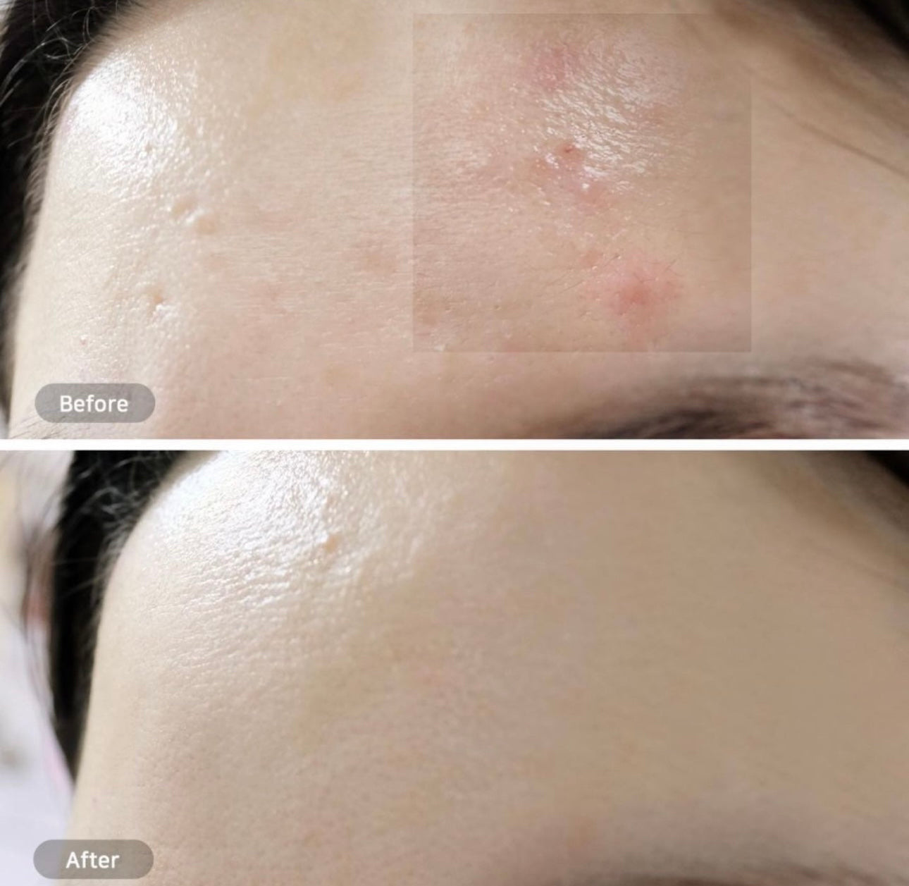 巨量裝🔥自留🌿韓國 Hwahae 美容大賞 No.1✨| Beplain 平衡pH值氨基酸絲滑綠豆洗面奶Beplain Greenful pH-balanced Cleansing Foam | 滿意度高達 98.4%🌿