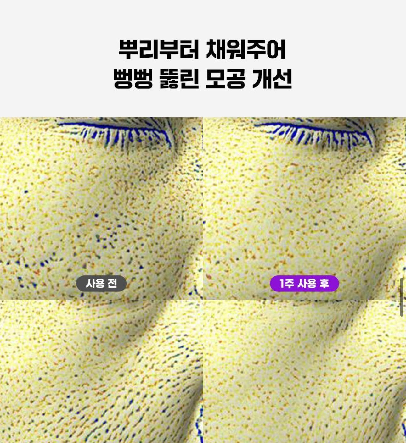 Fation深層緊緻收毛孔面霜 | Fation Nosca9 Pore Enhancing Cream 💜