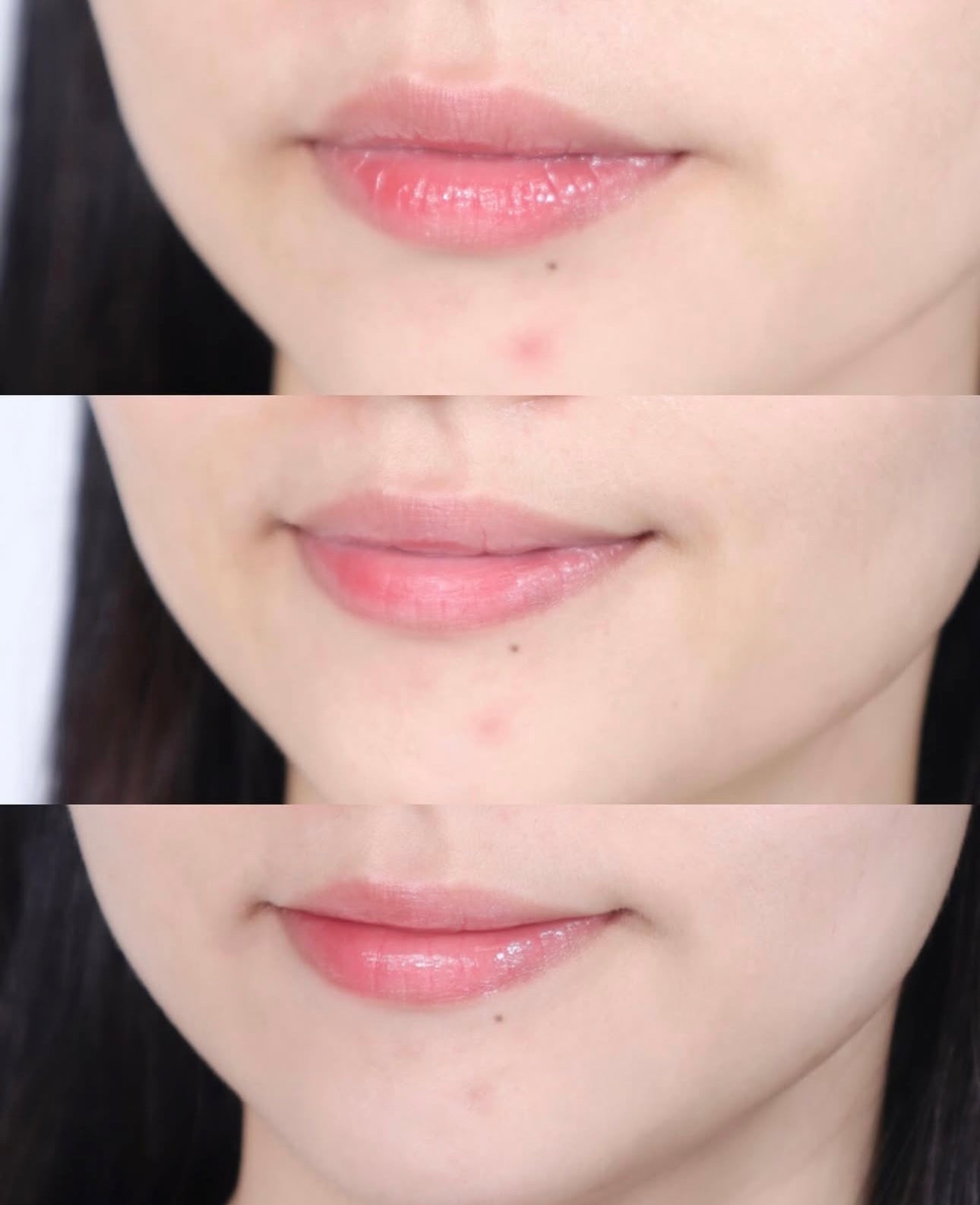 送去痘凝膠精華✨Centellian24 積雪草茶樹舒緩淨痘雙效修護粉