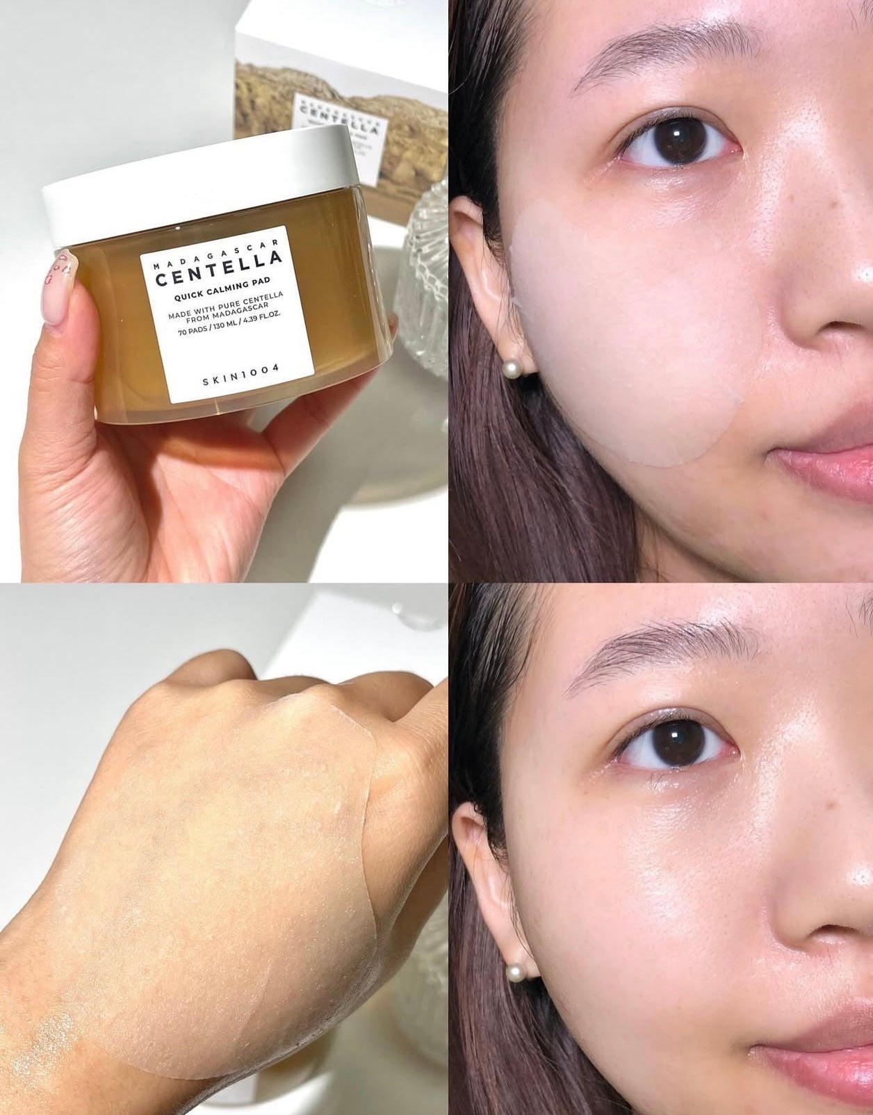 30秒舒緩爆痘肌✨| 韓國熱銷百萬片SKIN1004 馬達加斯加積雪草舒緩抗痘棉片☁️| SKIN1004 MADAGASCAR CENTELLA QUICK CALMING PAD