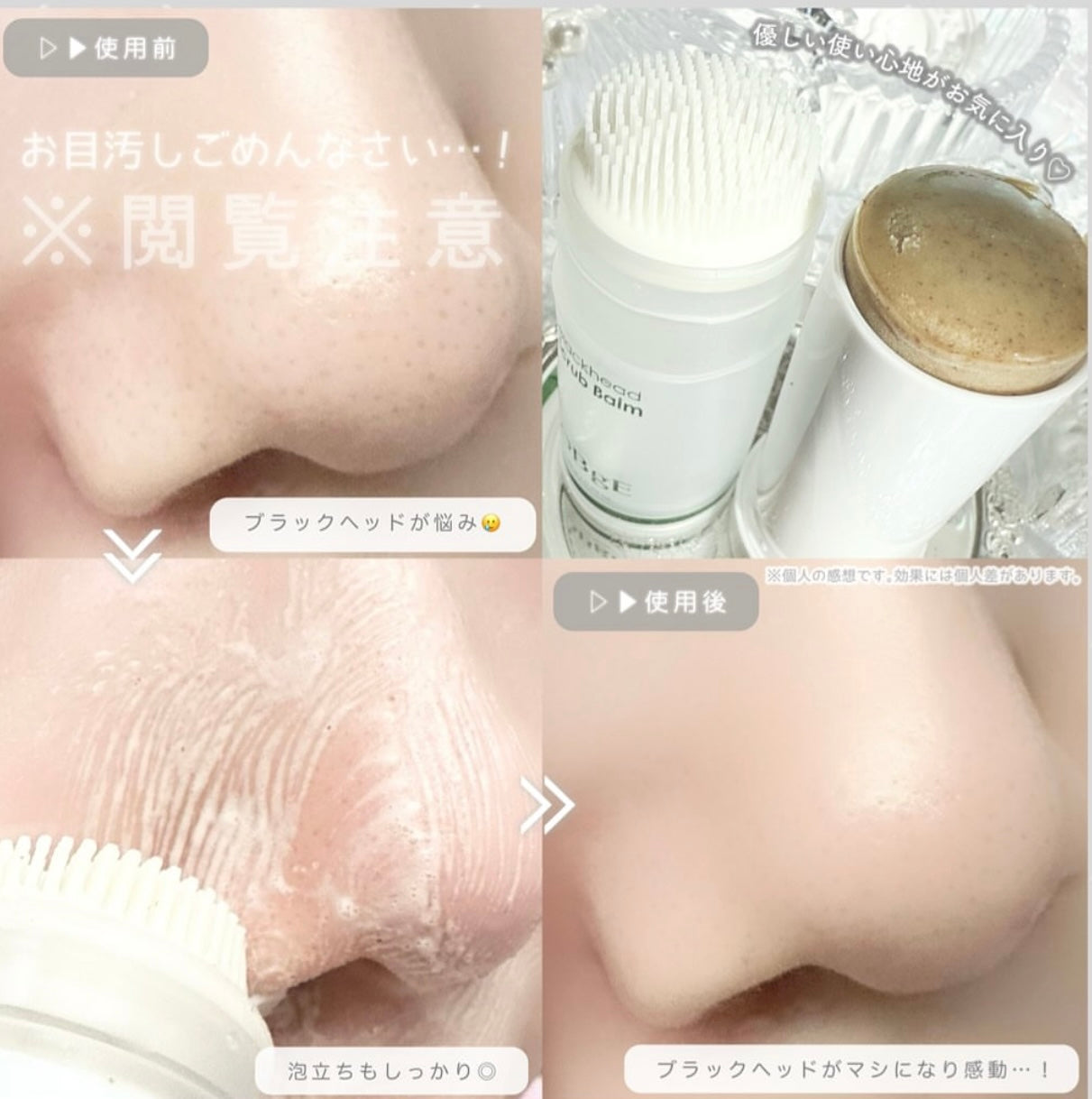 OBgE 黑頭粉刺去角質清潔棒🫧 OBgE Blackhead Scrub Balm✨ 一抹即淨、懶人首選 🚀