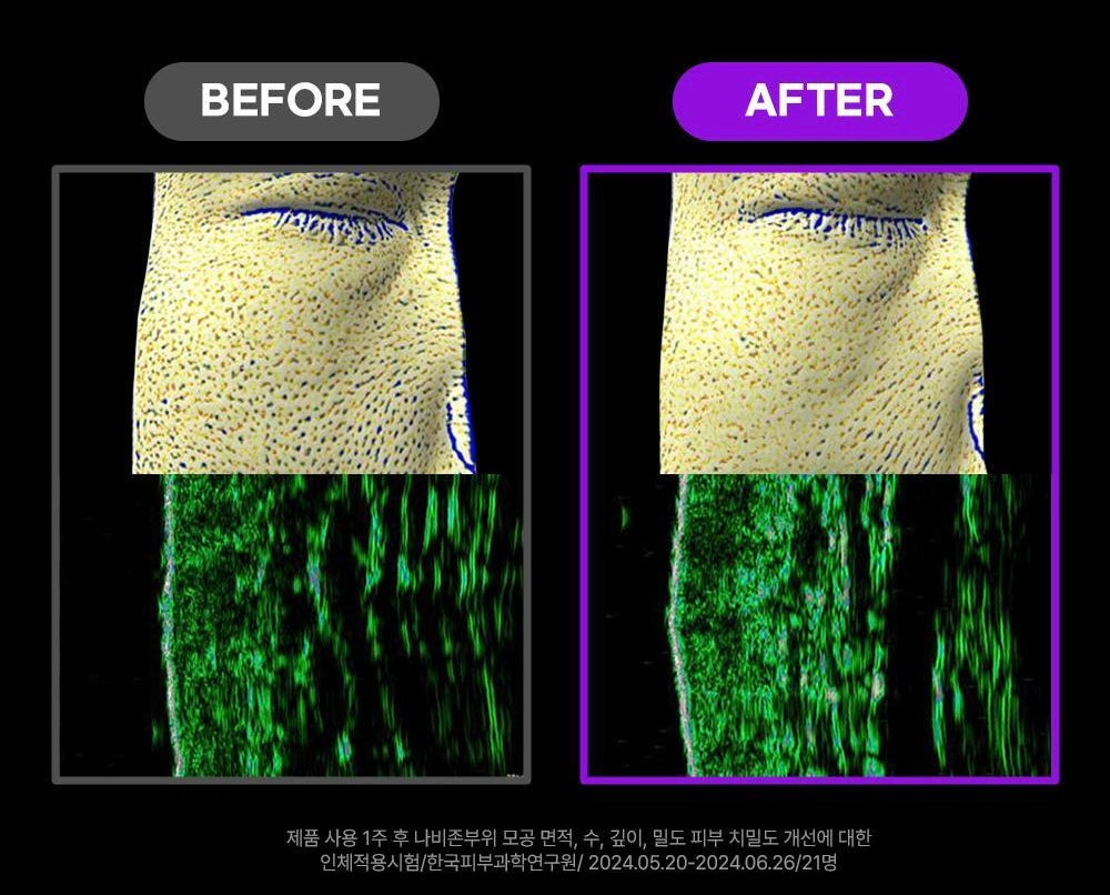 Fation深層緊緻收毛孔面霜 | Fation Nosca9 Pore Enhancing Cream 💜