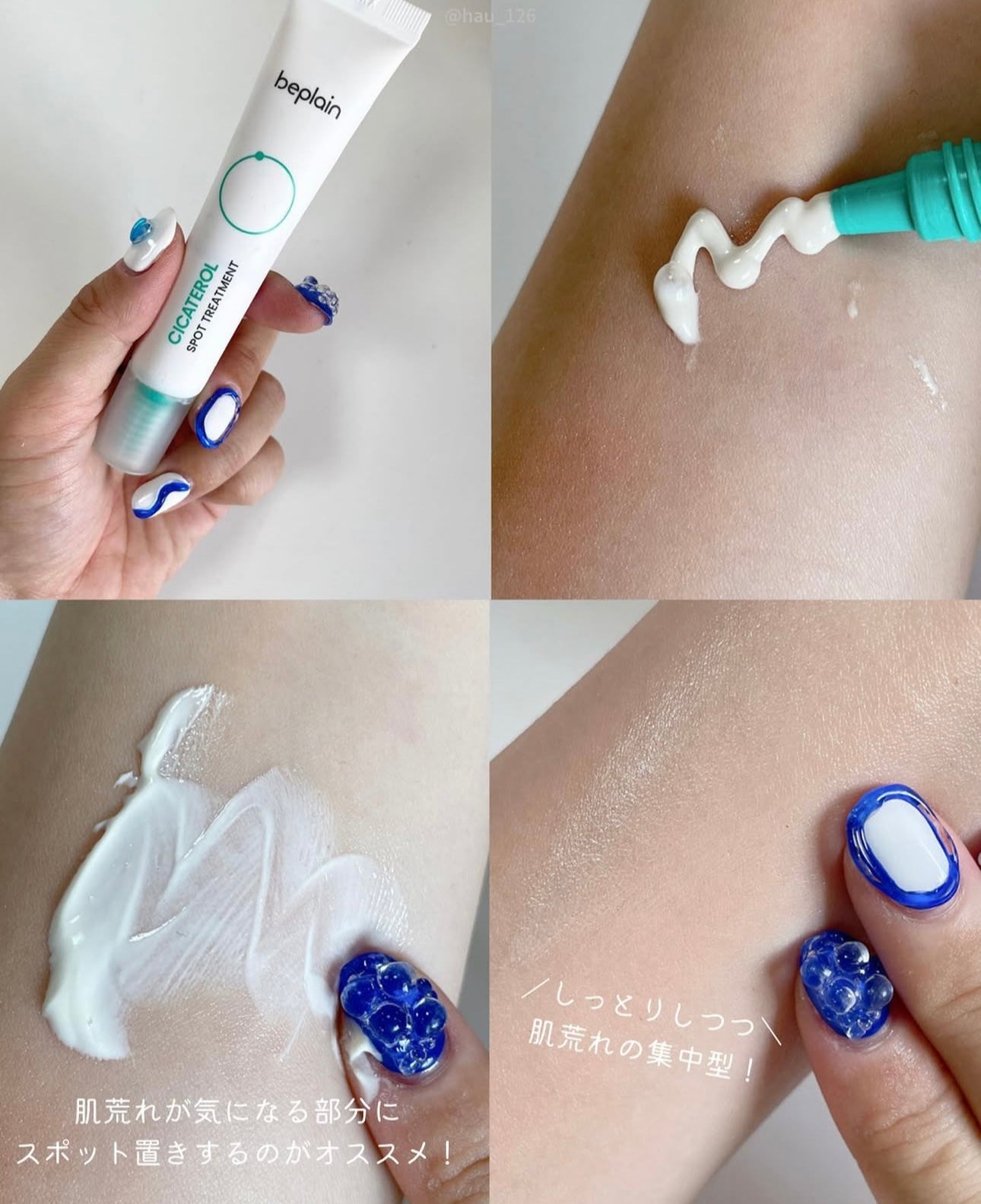 敏感痘痘肌必備✨| Beplain積雪草修復袪痘精華乳霜🌿Beplain Cicaterol Spot Treatment