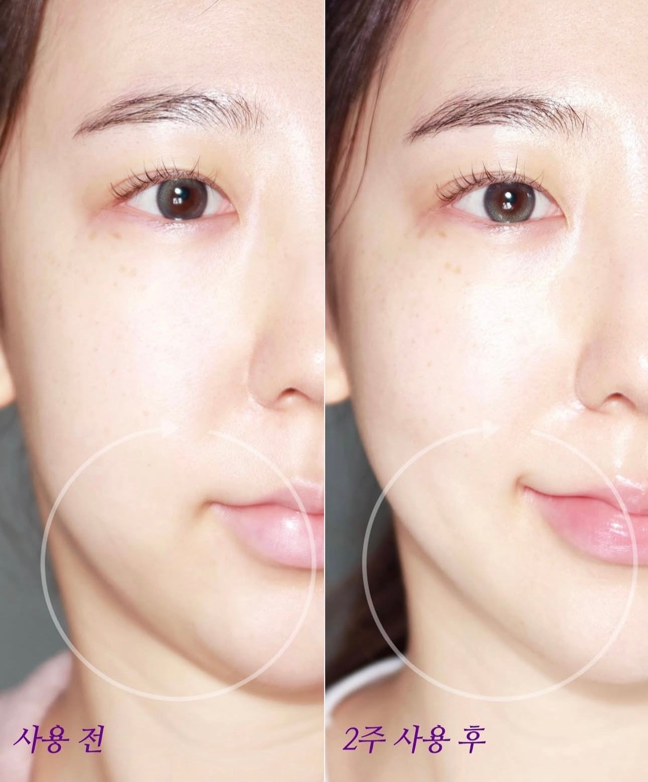 真正的提拉面霜✨BOH 益生菌3D立體提拉抗皺面霜💜 | Bio Heal BOH Probioderm 3D Lifting Cream