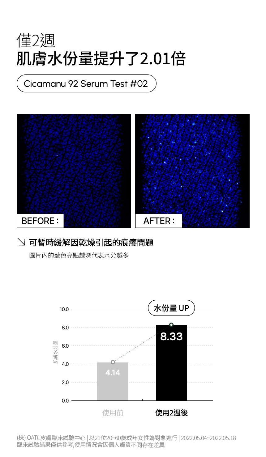 Parnell積雪草精粹92精華🌿| Parnell Cicamanu 92 Serum 刺激的肌膚兩週內回復狀態💚