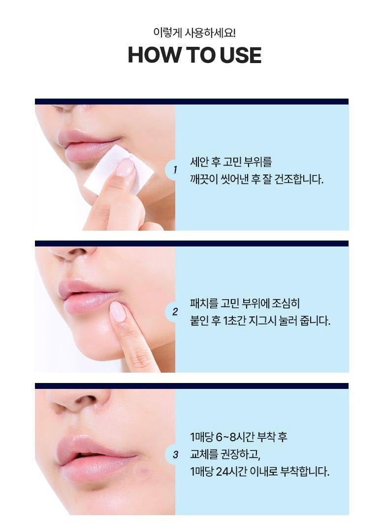 多送30貼✨人氣痘痘貼❤️‍🔥Olive Young 暗瘡貼✨真係超級薄🥰