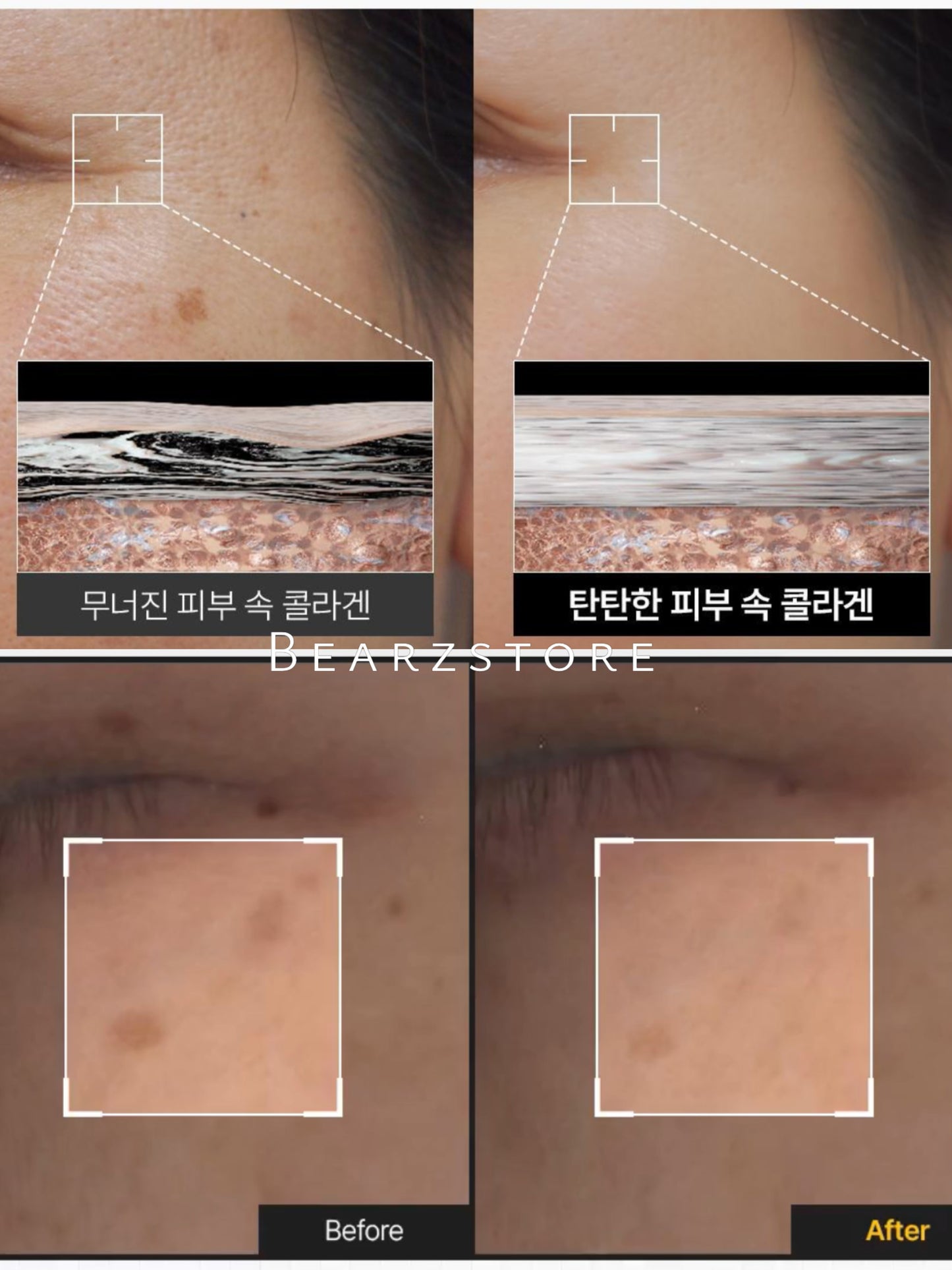 MEDIHEAL 膠原蛋白膠囊多效眼膜| 視黃醇 & 維他命C | 100小時膠原密度提升🔥