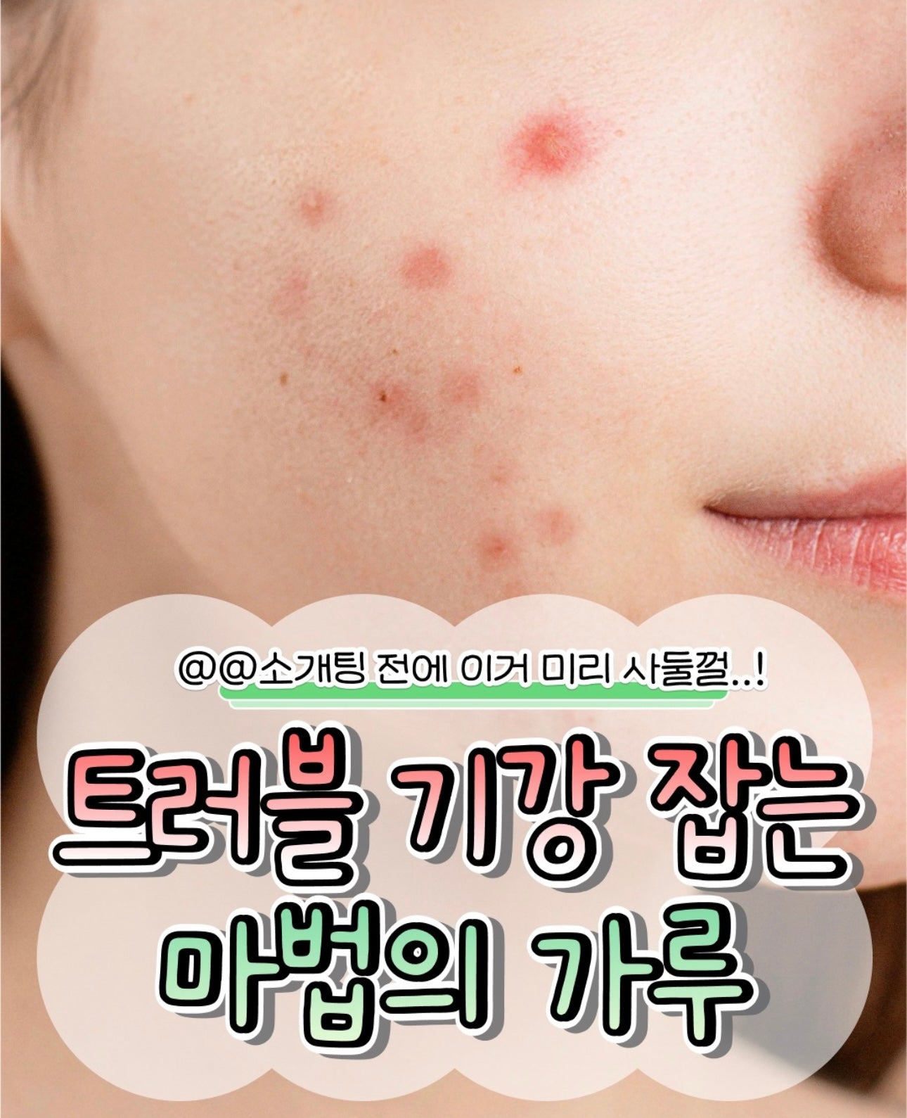 送去痘凝膠精華✨Centellian24 積雪草茶樹舒緩淨痘雙效修護粉