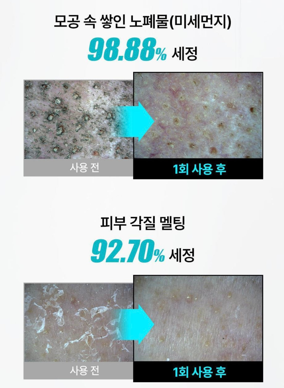 送Hello Kitty潔面刷✨ilso天然溫和溶黑頭清毛孔卸妝油套裝Ilso natural mild cleansing oil set🪄