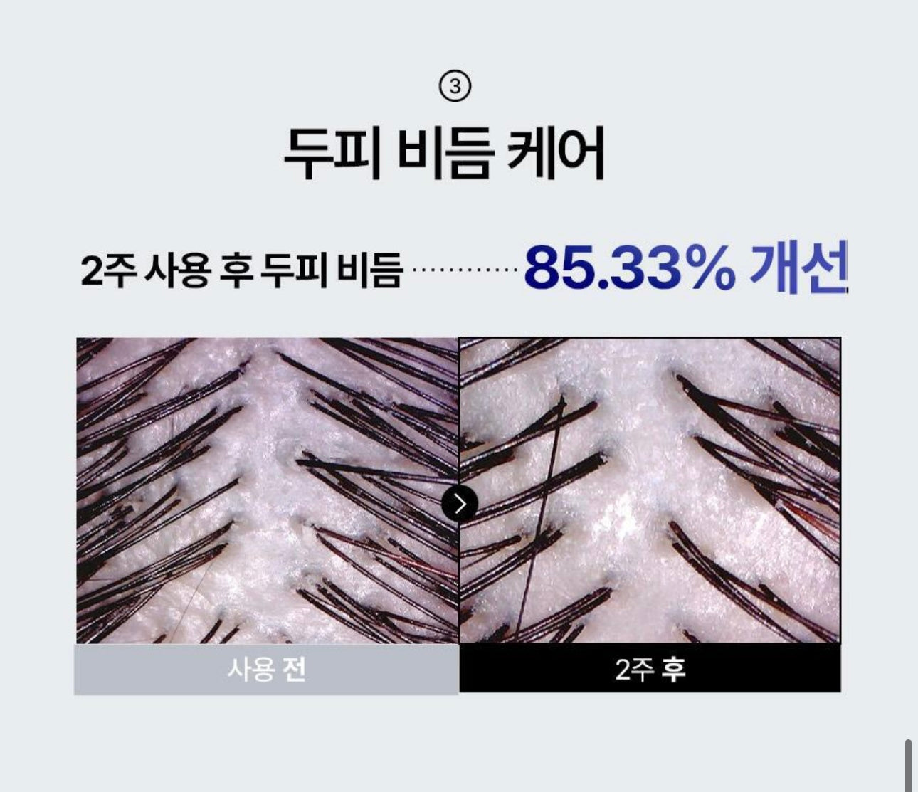 髮量危機的救星⭐️EPAIS 髮根賦活頭皮精華 🩶 EPAIS Scalp Boosting Ampoule