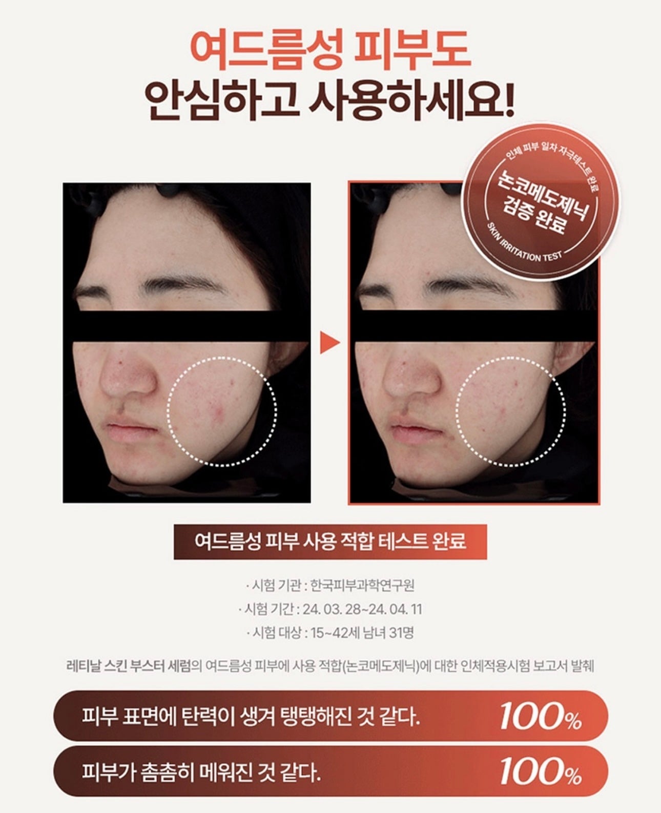 一週見效的即時感✨| MEDITHERAPY 抗痘修護視黃醛精華🌙| MEDITHERAPY Retinal Skin Booster Serum