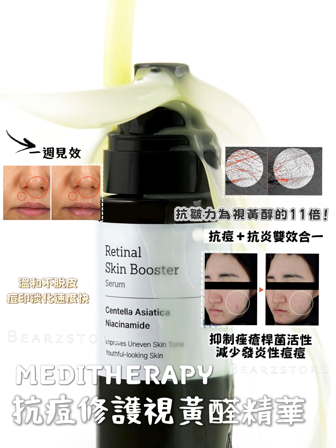 一週見效的即時感✨| MEDITHERAPY 抗痘修護視黃醛精華🌙| MEDITHERAPY Retinal Skin Booster Serum