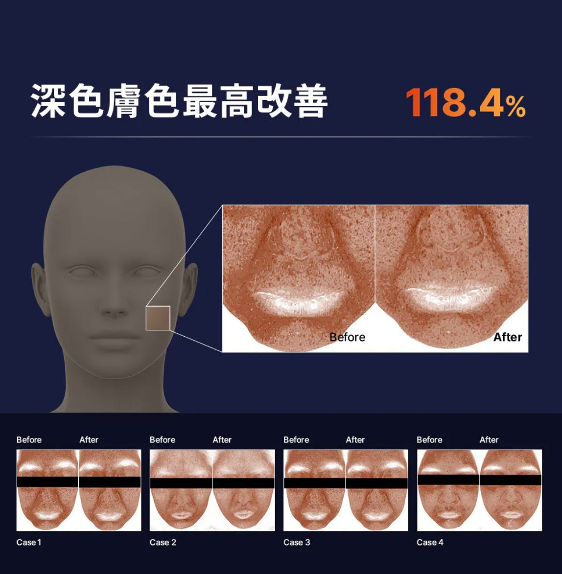 狂囤貨！一滴擦出發光肌✨ Mommy care⁠ 高純維他命C亮白淡斑精華Orthotamin Vitamin C Ampoule 🧡激發透亮感💡