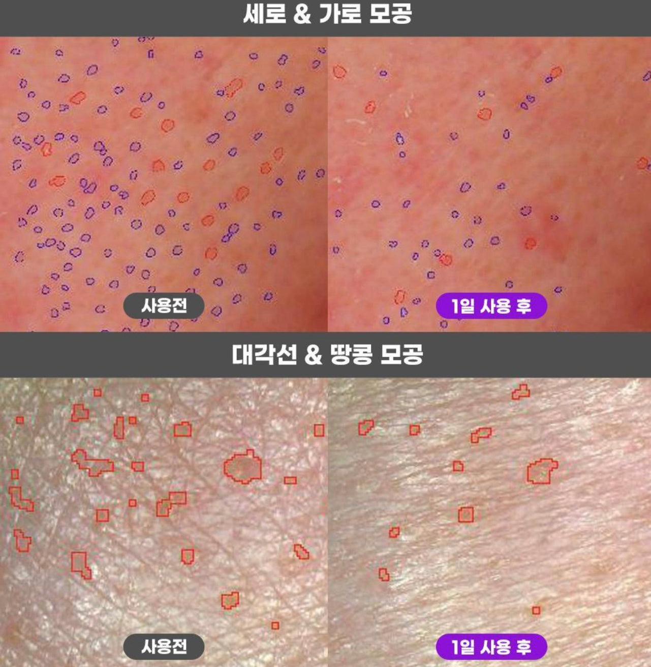 Fation深層緊緻收毛孔面霜 | Fation Nosca9 Pore Enhancing Cream 💜