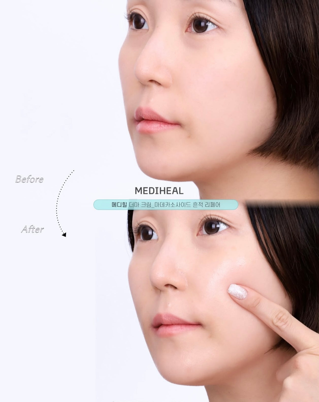 MEDIHEAL 98%積雪草抗炎去印去痕跡修護霜🩵| MEDIHEAL MADECASSOSIDE DERMA ACTIVE CAPSULE CREAM