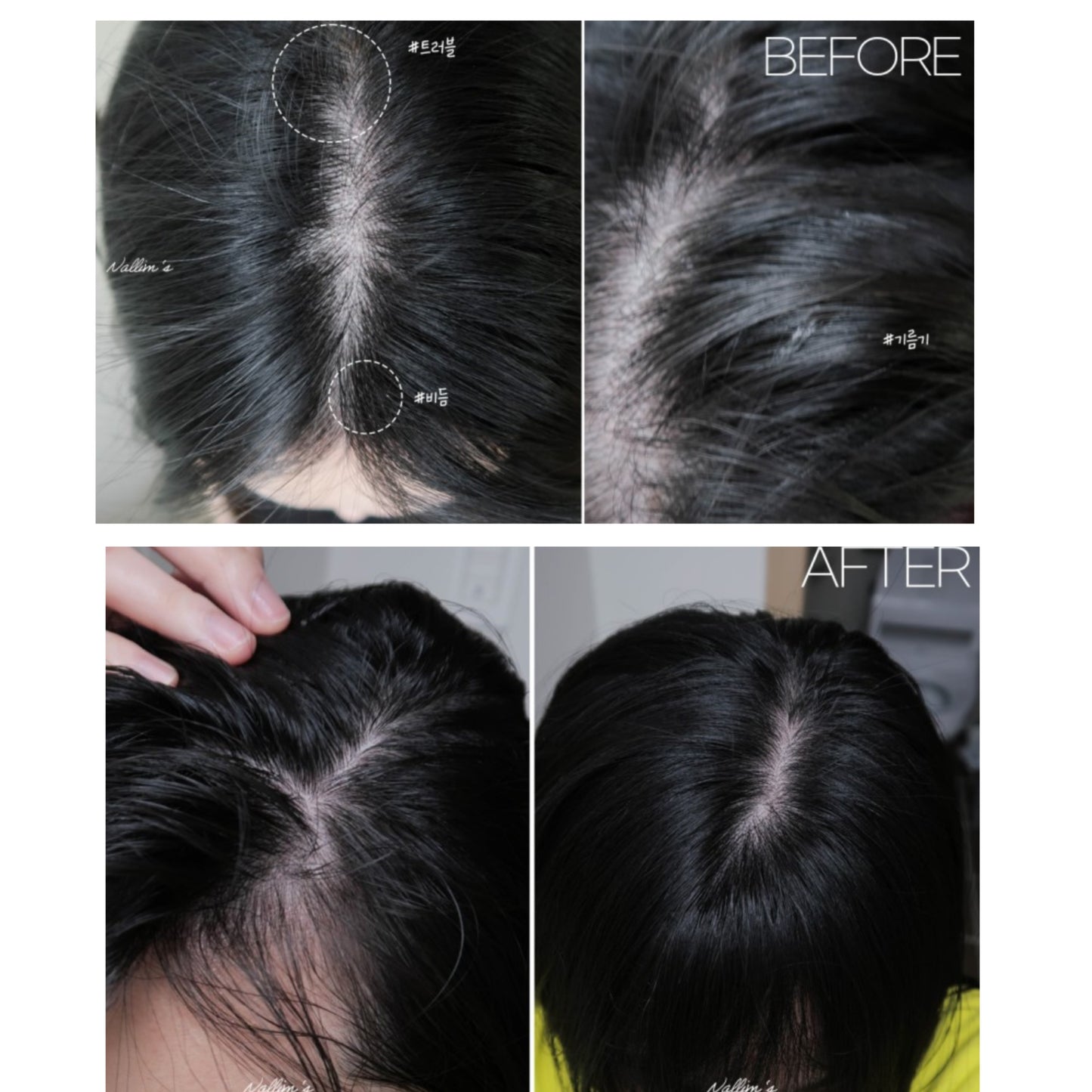 海水浴療法💆🏼‍♀️| GROWUS Sea Salt Therapy Scalp Scaler 海鹽去角質磨砂膏💫 韓國銷量冠軍產品 No.1🥂