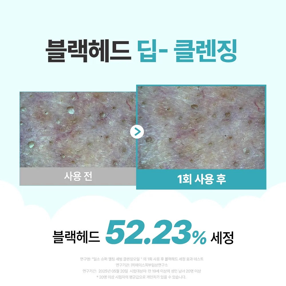 多送30ml✨ilso 天然溫和溶黑頭清毛孔卸妝油套裝Ilso natural mild cleansing oil set🪄