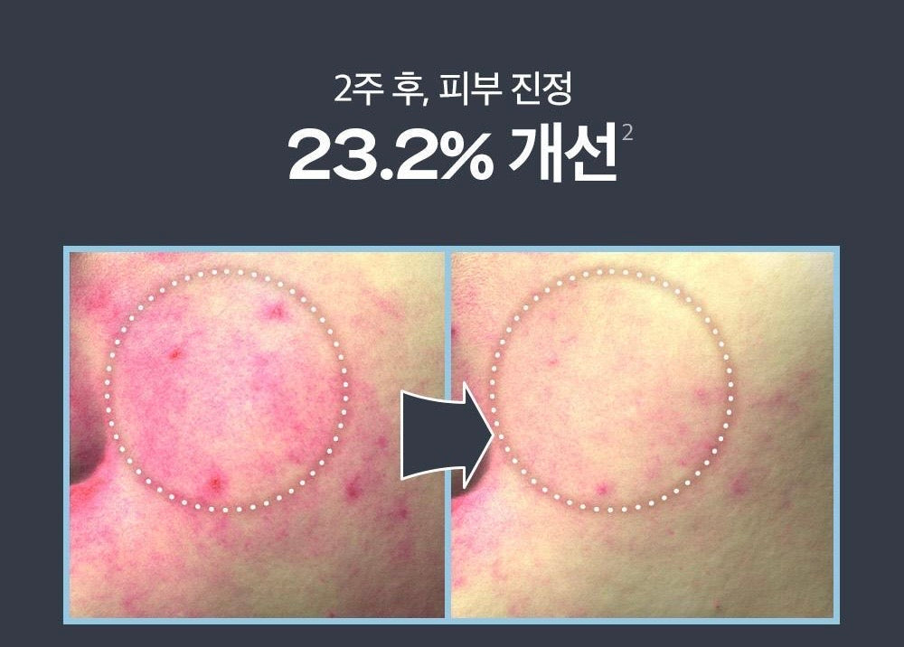 🌿 刷酸天花板！PAULA'S CHOICE 2%水楊酸精華液 PAULA'S CHOICE BHA Liquid Exfoliant