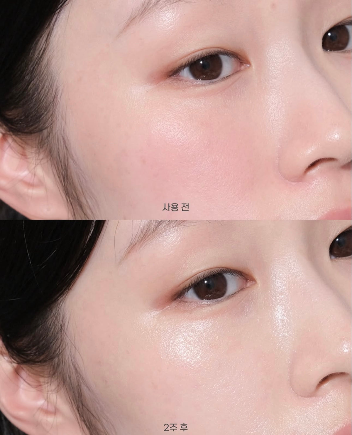 MEDIHEAL x 布丁狗🍮限量聯名✨升級版🔥強效淡印修復痕跡補水精華🩵 DERMA SERUM MADECASSOSIDE
MOISTURE BLEMISH