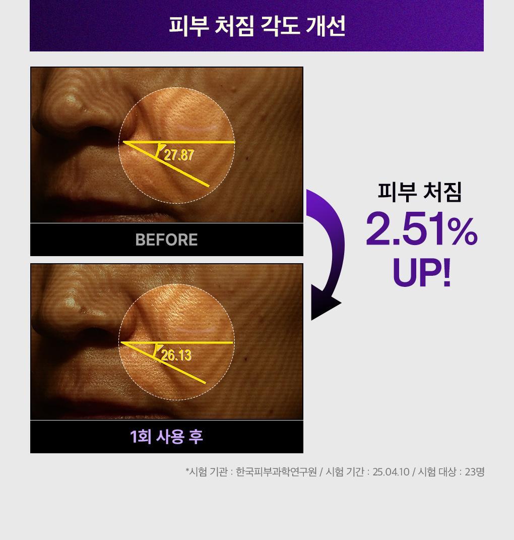 1+1裝✨ MEDIHEAL PDRN 角鯊烷緊緻修護精華💜